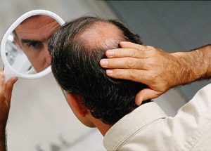 مو-آلپسین